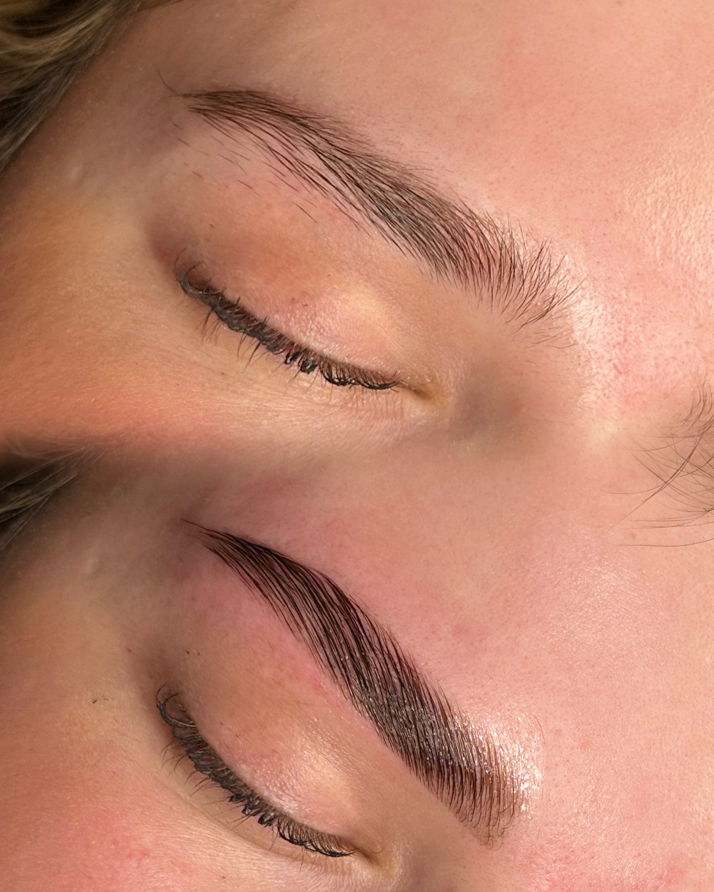 Browlift Course